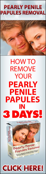 ppp home removal
